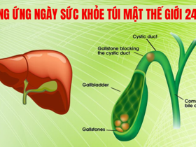 [Giải đáp] Cách để có túi mật khỏe mạnh ngăn ngừa sỏi mật